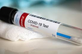 Greater Shepparton COVID-19 cases continue to climb post image